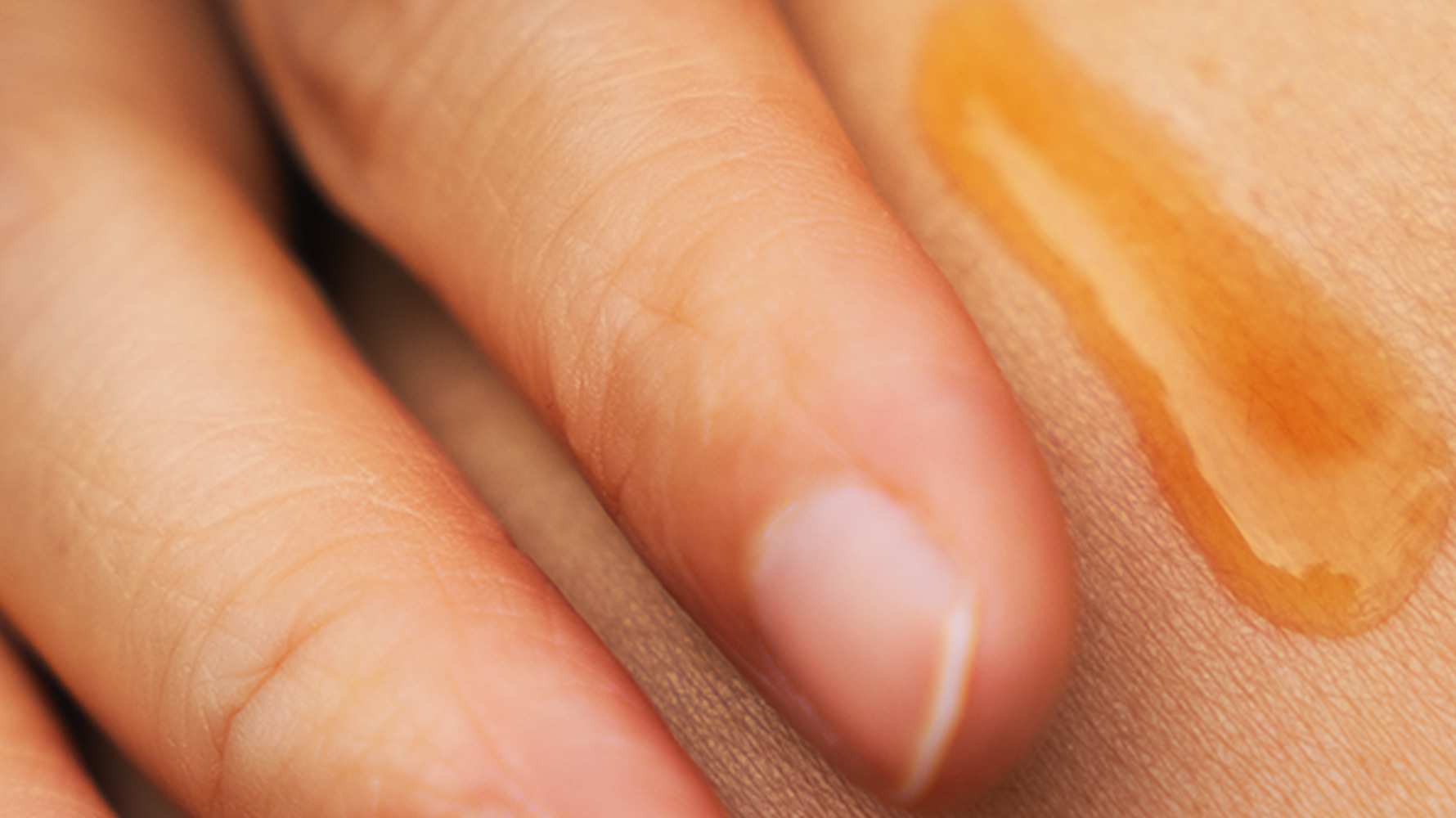 Why Transparancy Matters